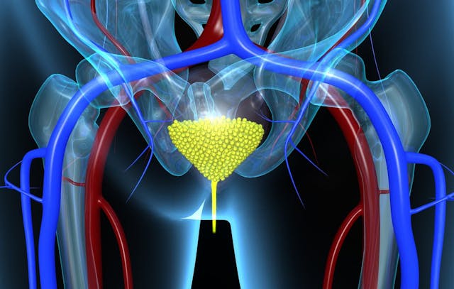 Data from the phase 3 EV-302 trial support an application for enfortumab vedotin plus pembrolizumab as a treatment for patients with advanced bladder cancer in China.