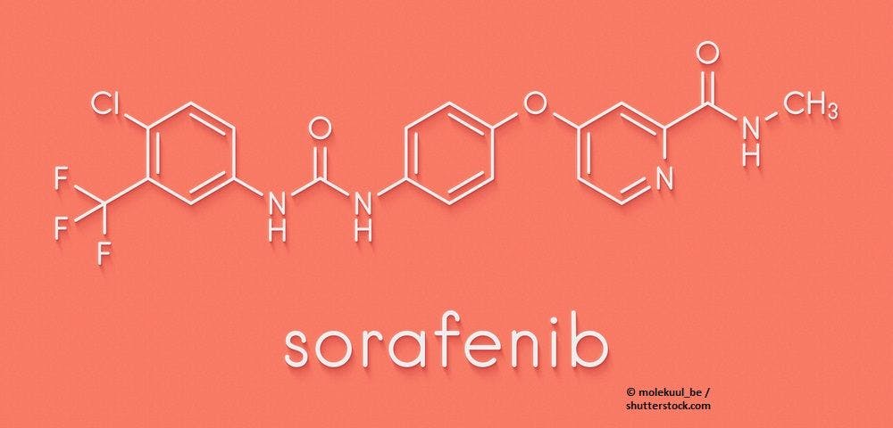 Sorafenib Offers Survival Improvements in Ovarian Cancer