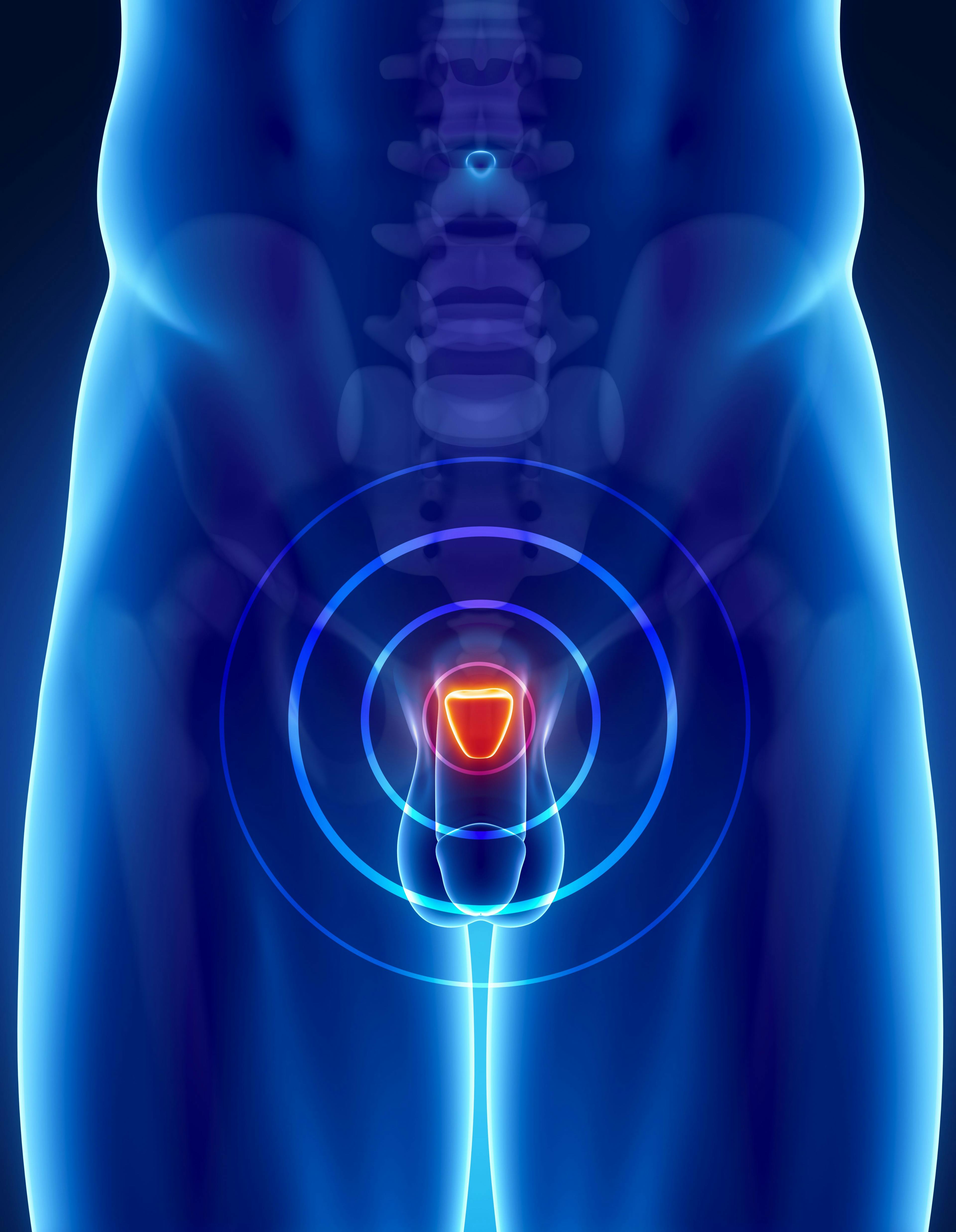PET Radiotracer Boosts Survival in Postprostatectomy Salvage Radiotherapy