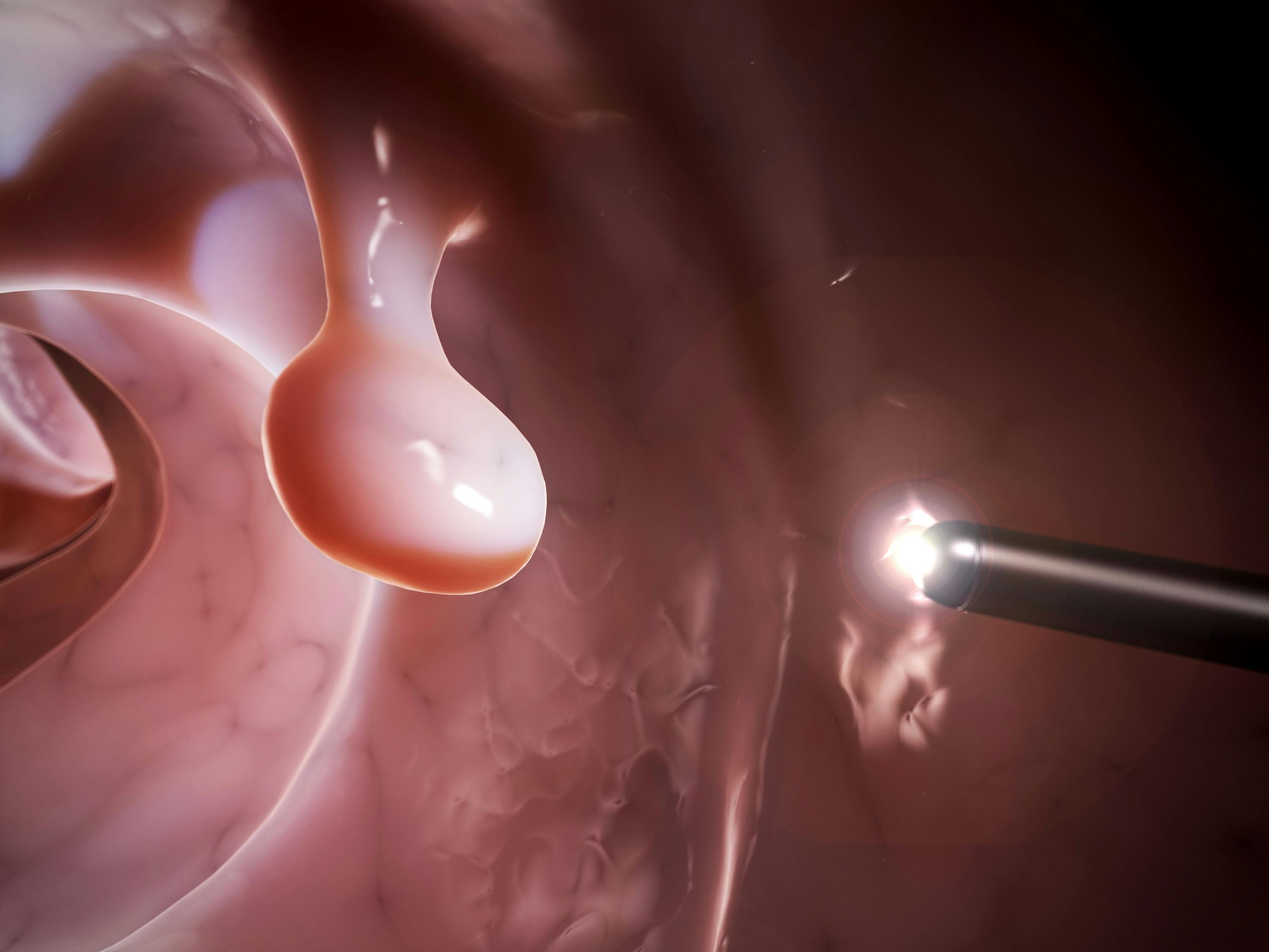 3D rendering of a colonoscopy