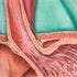 Study: Recurrent Heartburn Ups Risk for Throat Cancer