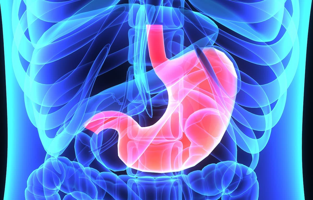 Investigators Pool Data to Better Classify Prognosis in Gastric Tumor 