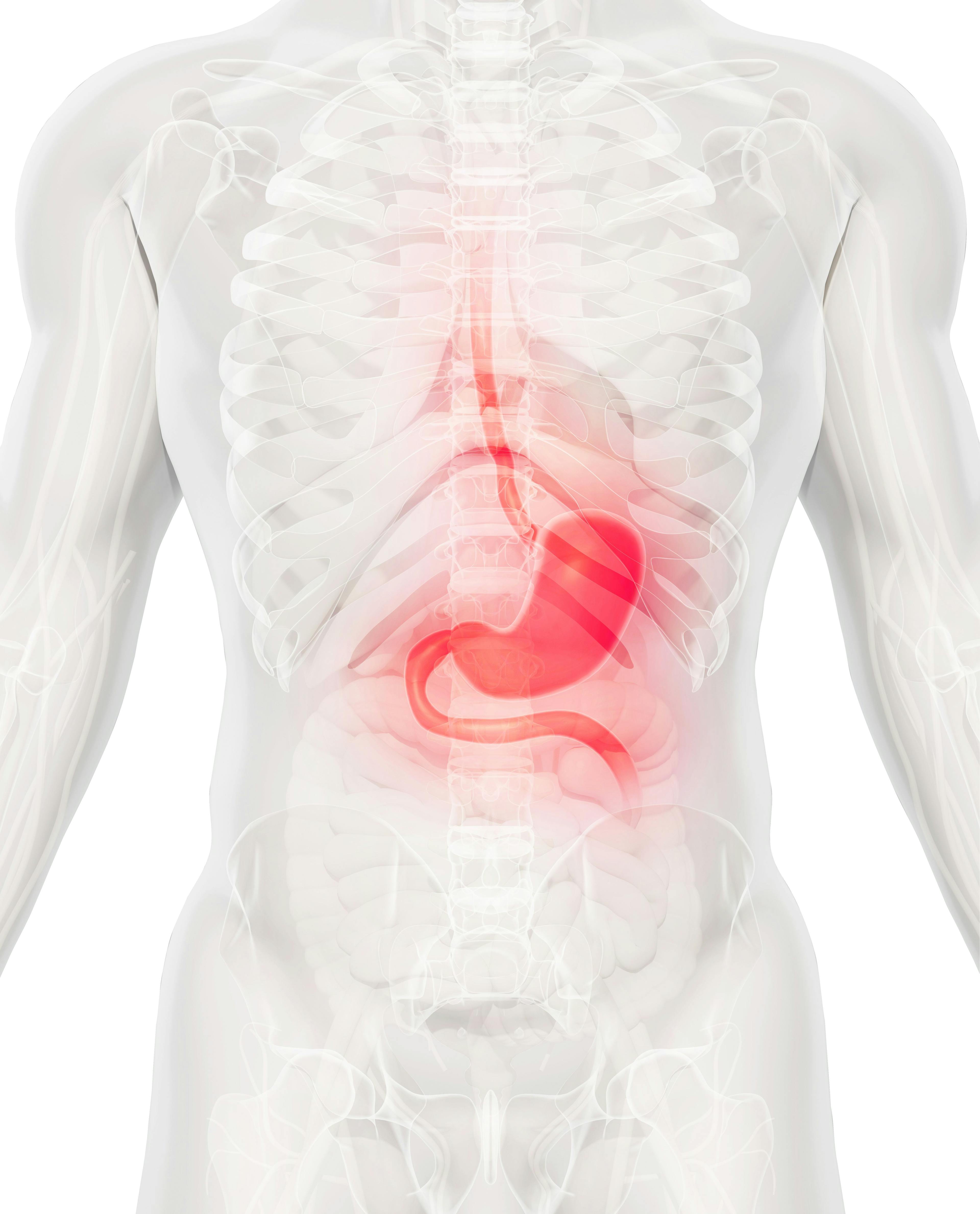 Findings from the FRUTIGA study support fruquintinib plus paclitaxel as a promising second-line treatment for those with advanced gastric or gastroesophageal junction adenocarcinoma following prior chemotherapy.