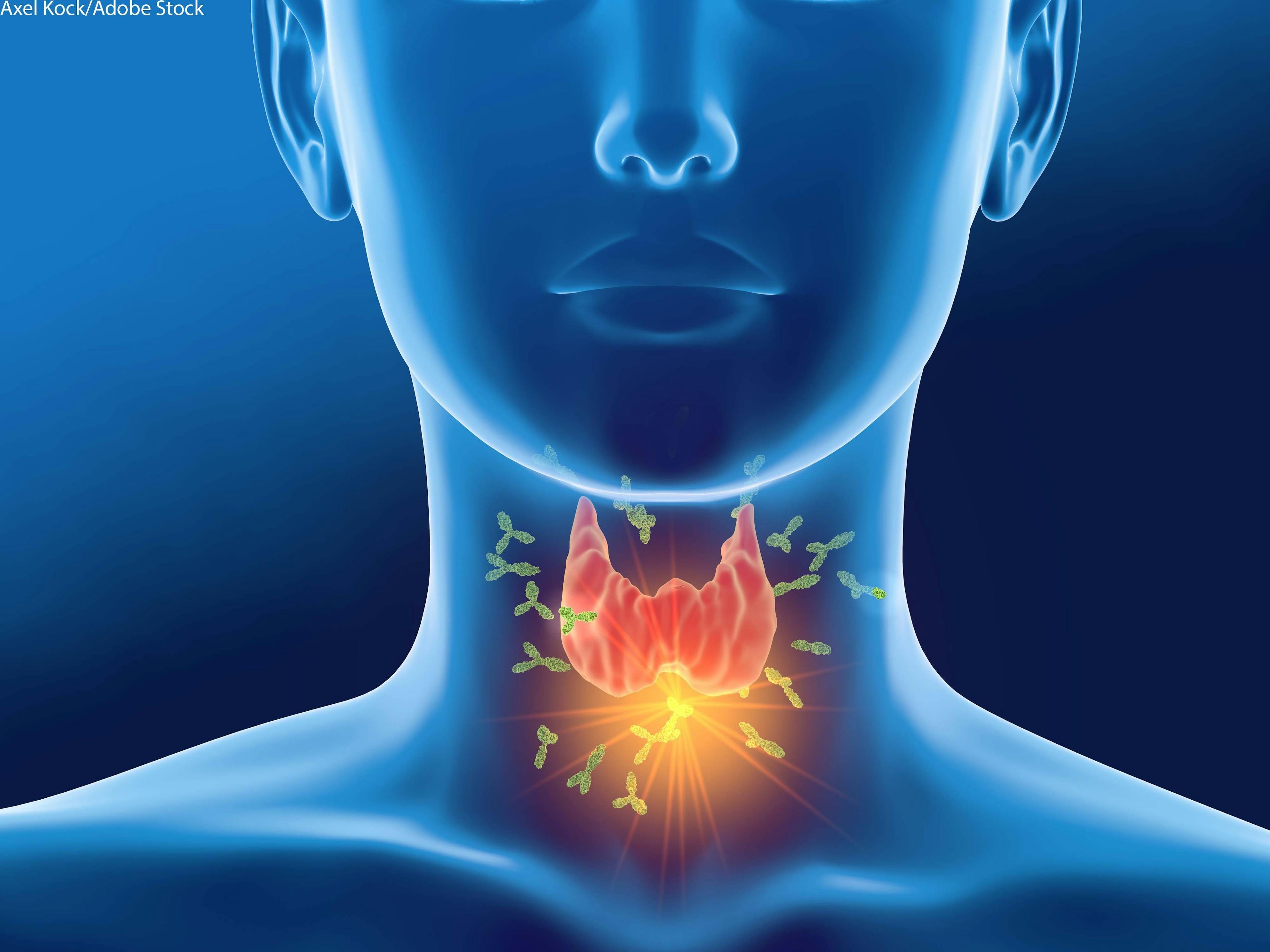 Voice Abnormalities Prevalent After Thyroid Surgery