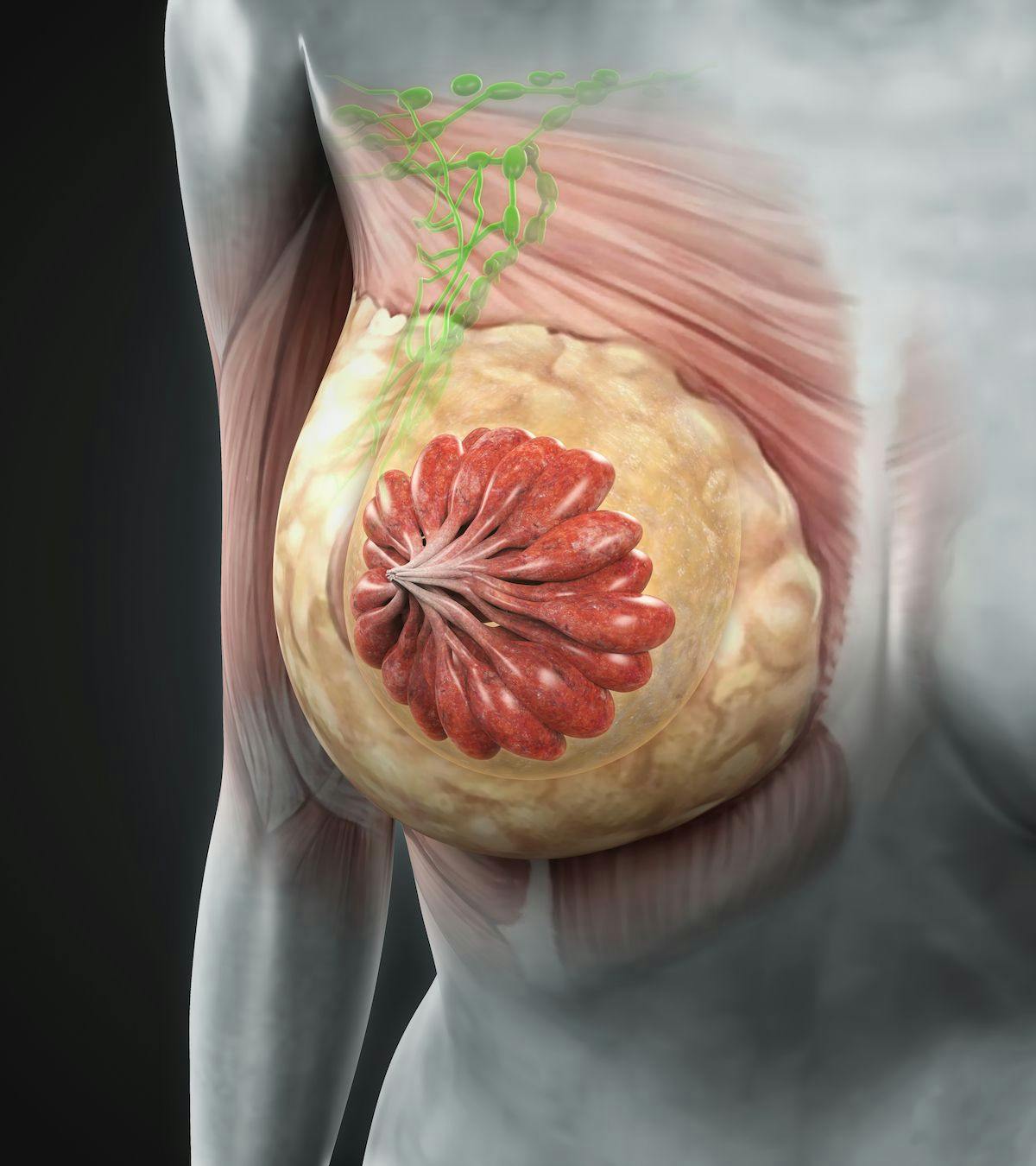 Findings from a phase 3 trial highlight regression of central nervous system metastases across all heavily pretreated breast cancer subtypes with Bria-IMT.