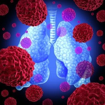 Treatment with socazolimab plus carboplatin and etoposide appears safe in patients with small cell lung cancer, according to preliminary phase 1 study findings.