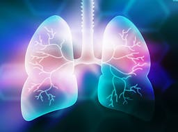 In April 2024, the FDA approved alectinib for the adjuvant treatment of patients with ALK-positive non–small cell lung cancer with tumors that are at least 4 cm or node-positive as detected by an FDA-approved test.