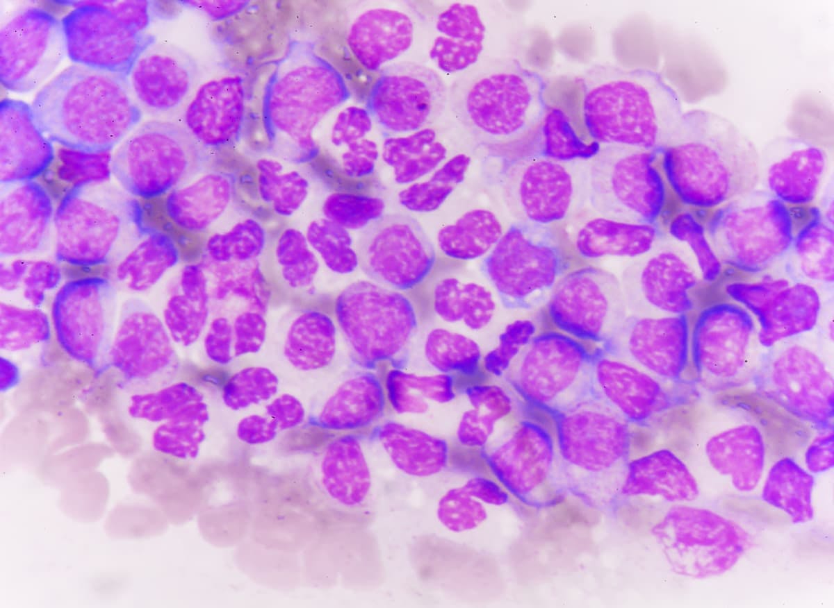 Further research is necessary to determine whether regular DNA sequence testing for residual disease variants in patients with acute myeloid leukemia can improve outcomes.