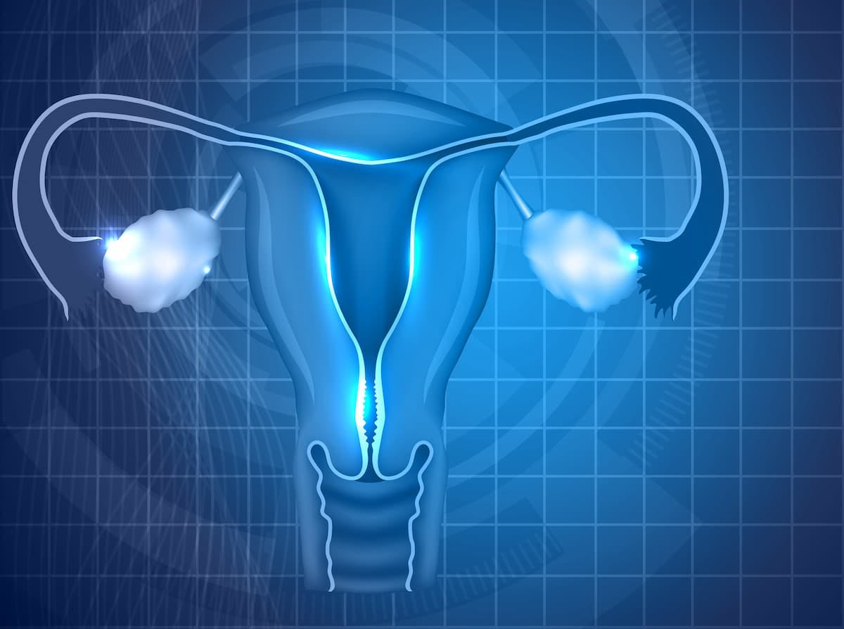 High-Risk Ovarian Cancer Benefits From Niraparib Plus Bevacizumab Combo After Platinum-Based Therapy