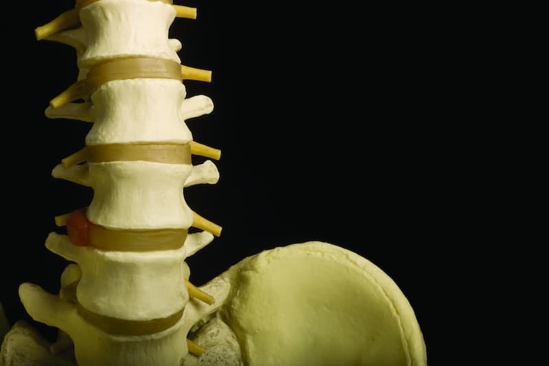 A biologic license application for a biosimilar of denosumab is under review by the FDA for managing osteoporosis and treatment-induced bone loss in those with cancer.