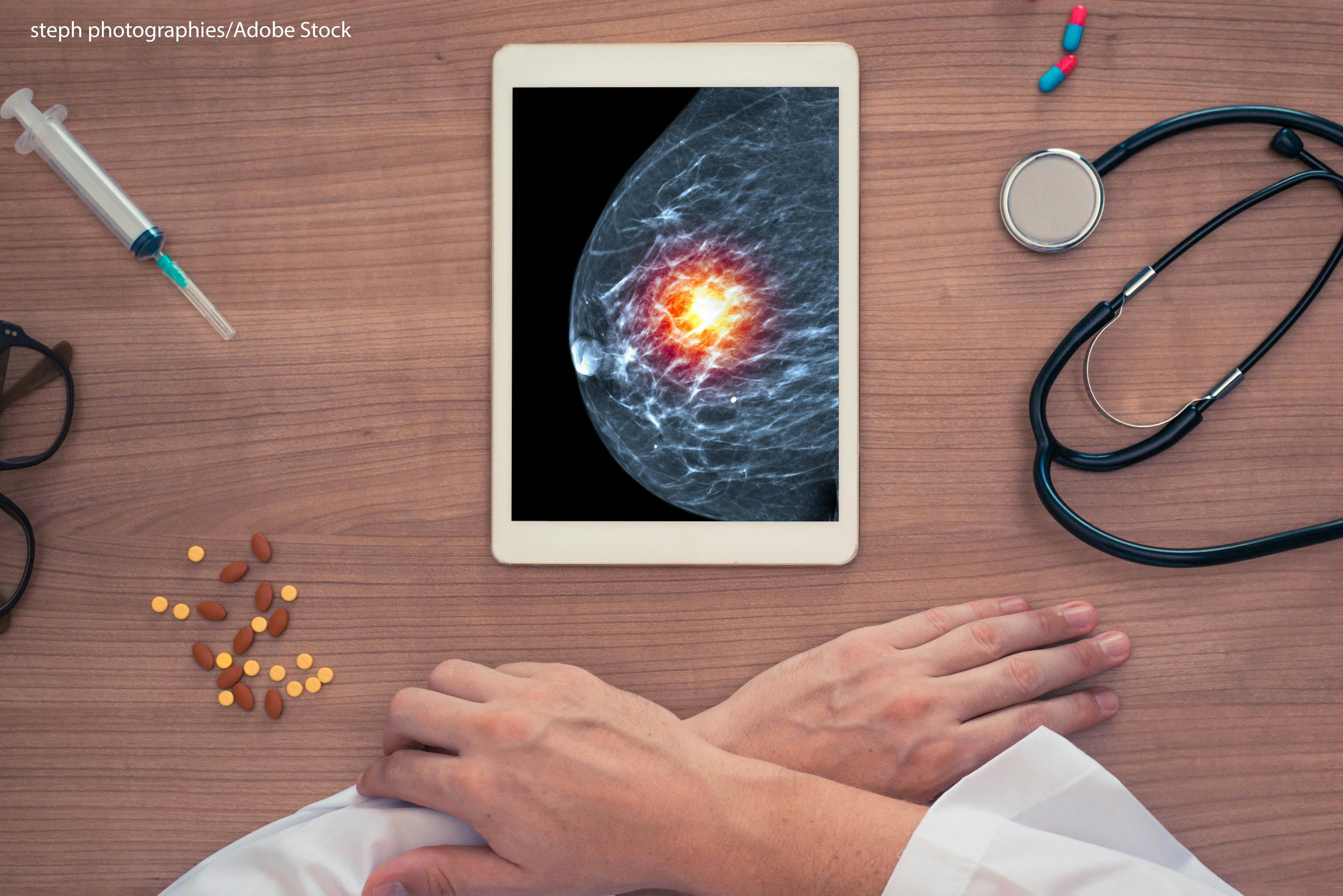 USPSTF Updates Guidelines on Preventive Medications for Breast Cancer 