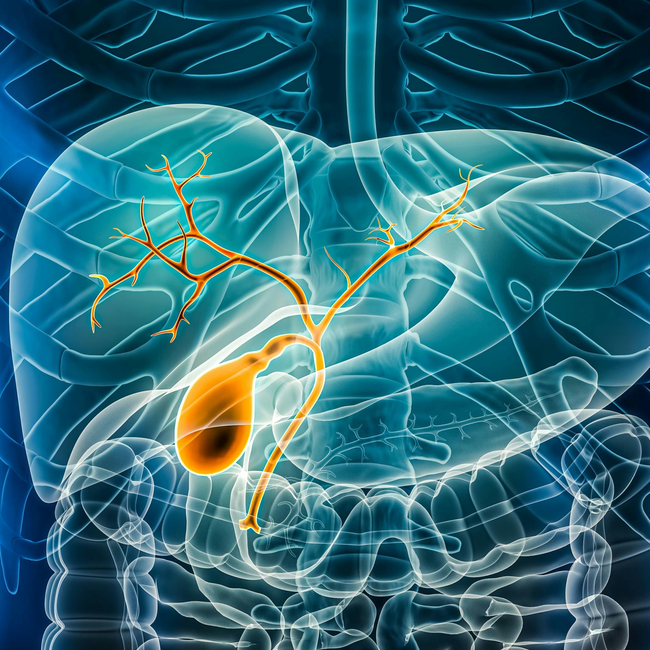 "Zanidatamab demonstrated antitumor activity, including rapid and durable responses in patients with treatment-refractory HER2-positive biliary tract cancer," according to an expert from the University of Texas MD Anderson Cancer Center.