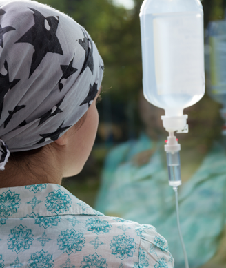 Early-Onset Alopecia May Signal Chemotherapy Response for Ovarian Cancer