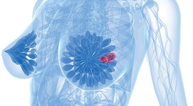 Leronlimab Provides a Significant Survival Benefit in Metastatic Triple-Negative Breast Cancer