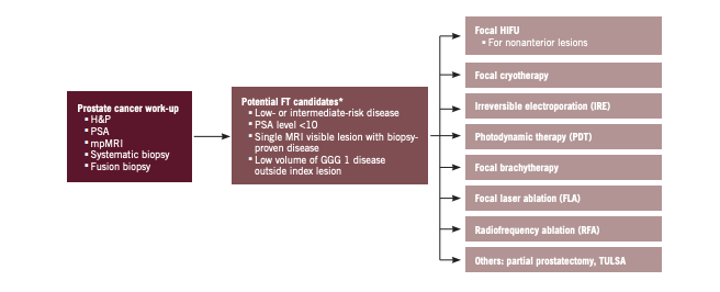 Primary Focal Therapy for Localized Prostate Cancer: A Review of the Literature 