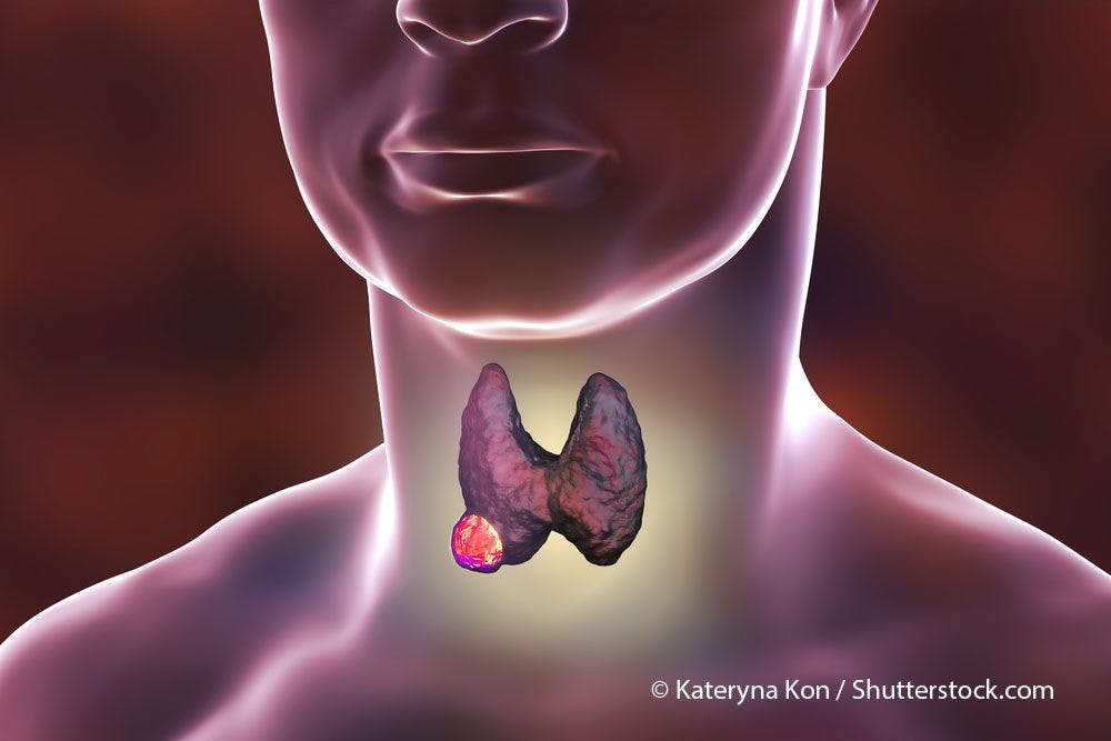 Eighth Edition of AJCC/TNM Staging System Best at Detecting Survival in Thyroid Cancer