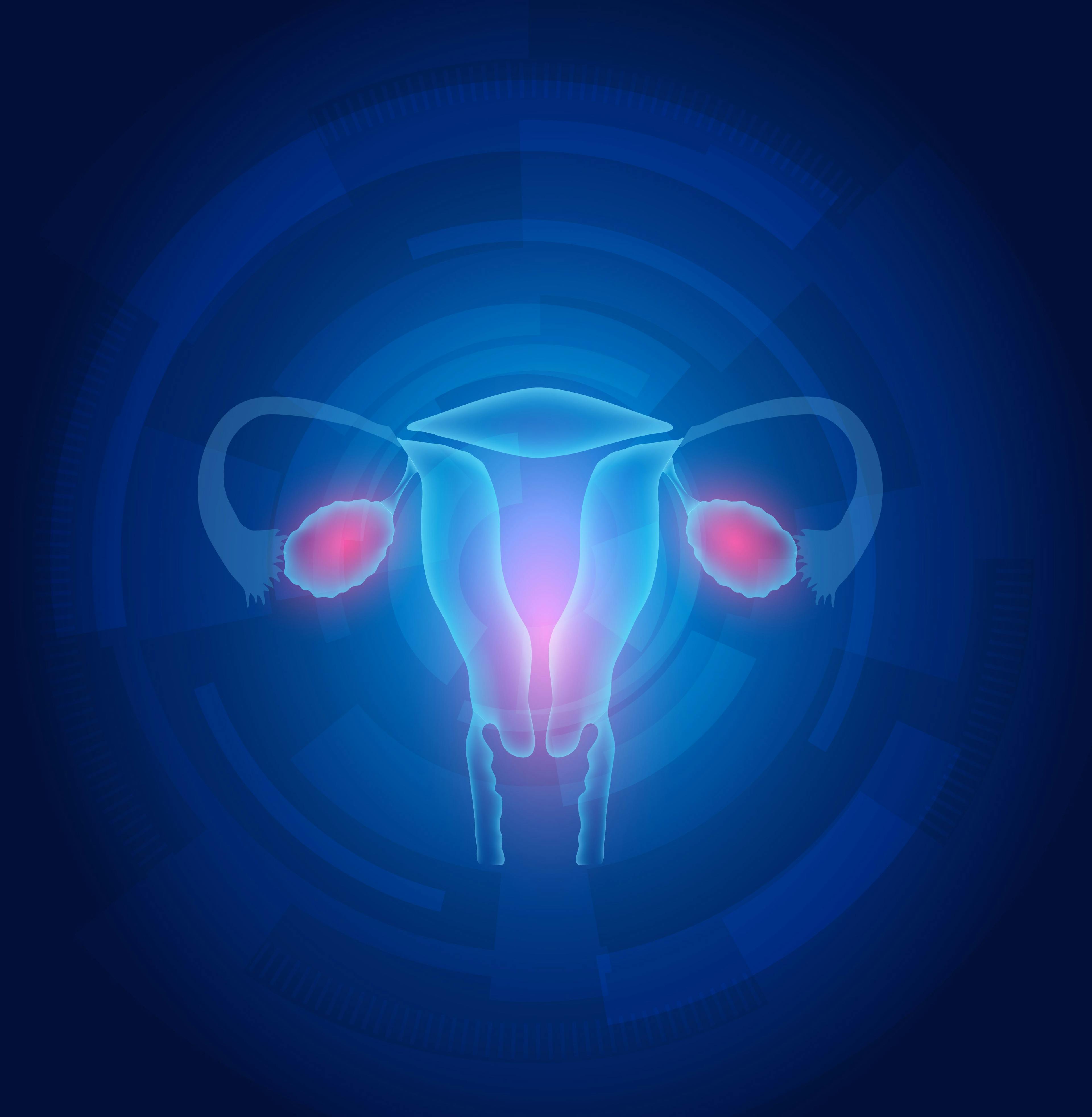 PFS Enhanced With Olaparib Rechallenge in Relapsed Ovarian Cancer After Prior PARP