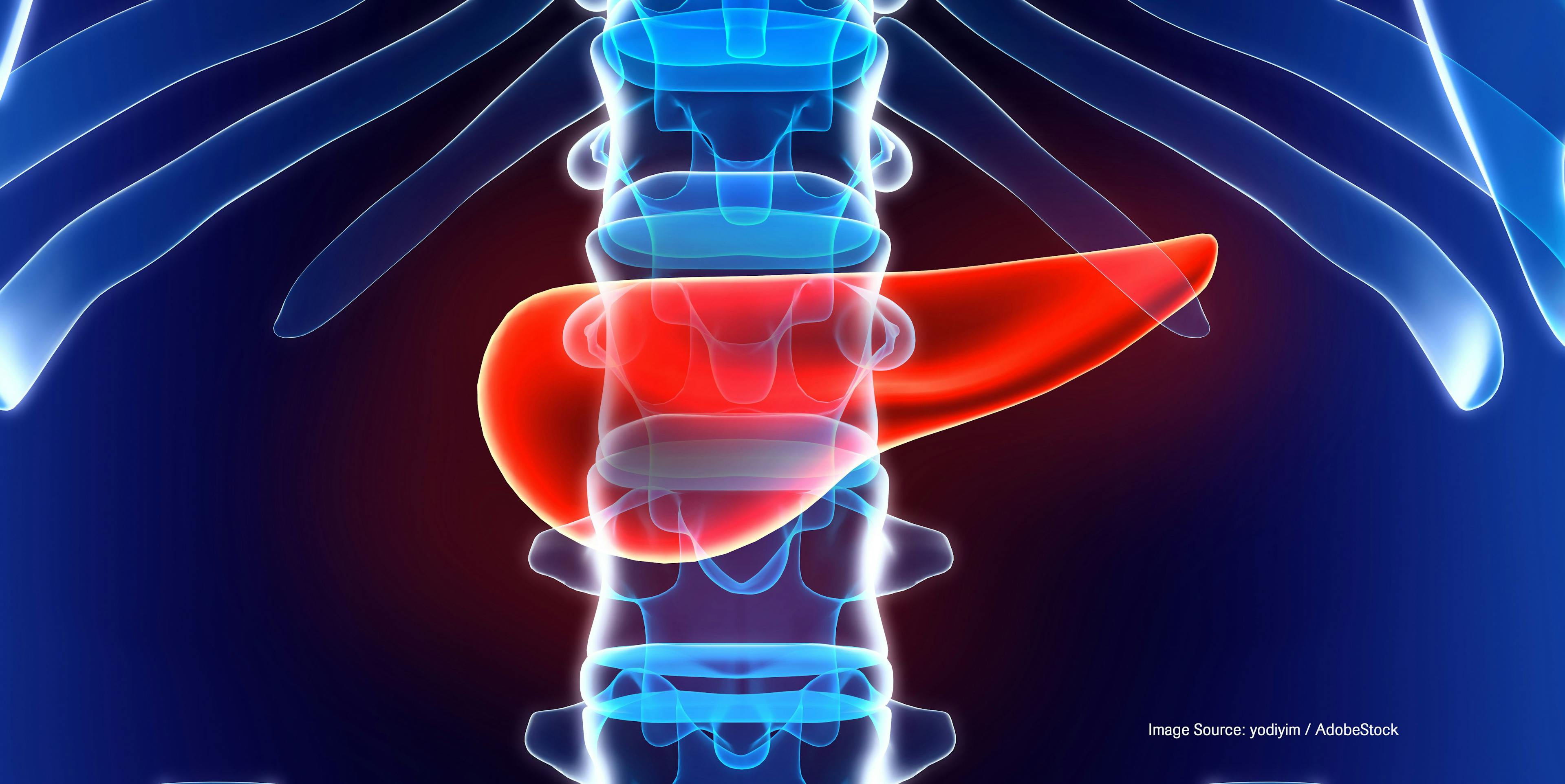 Adjuvant Therapy Questioned for Patients With Small Pancreatic Tumors