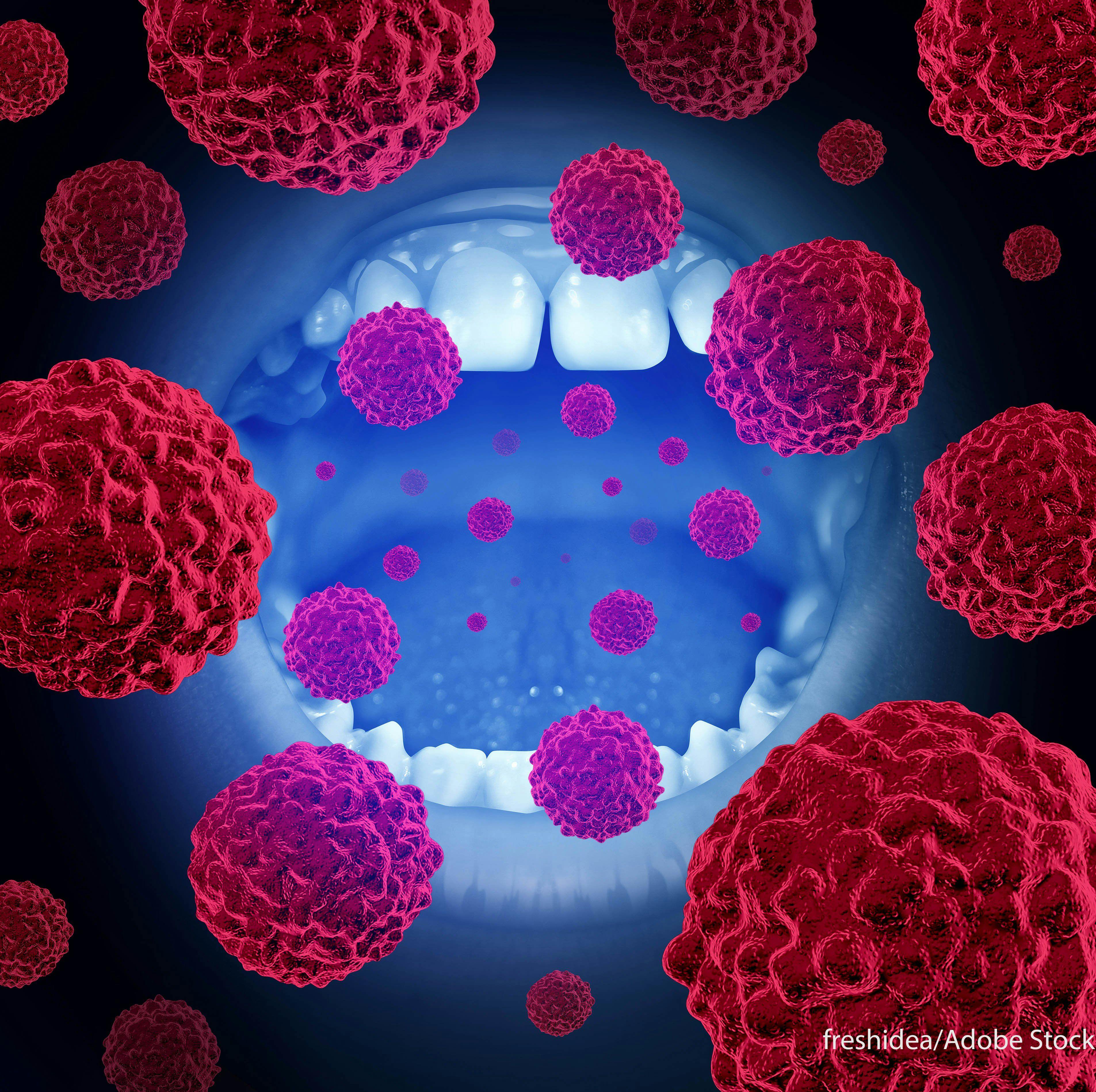 Should Surveillance Schedules Apply to HPV-Associated Oropharyngeal Squamous Cell Carcinomas?