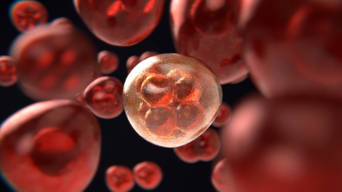 ALPHA2 Trial of ALLO-501A Allogeneic CAR T-cell Therapy Placed on Hold Due to Chromosomal Abnormality Event