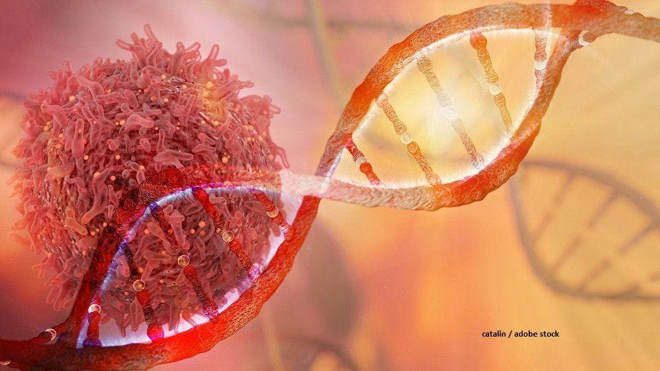 Quiz: Which Germline Mutations Are Linked to Ovarian Cancer?