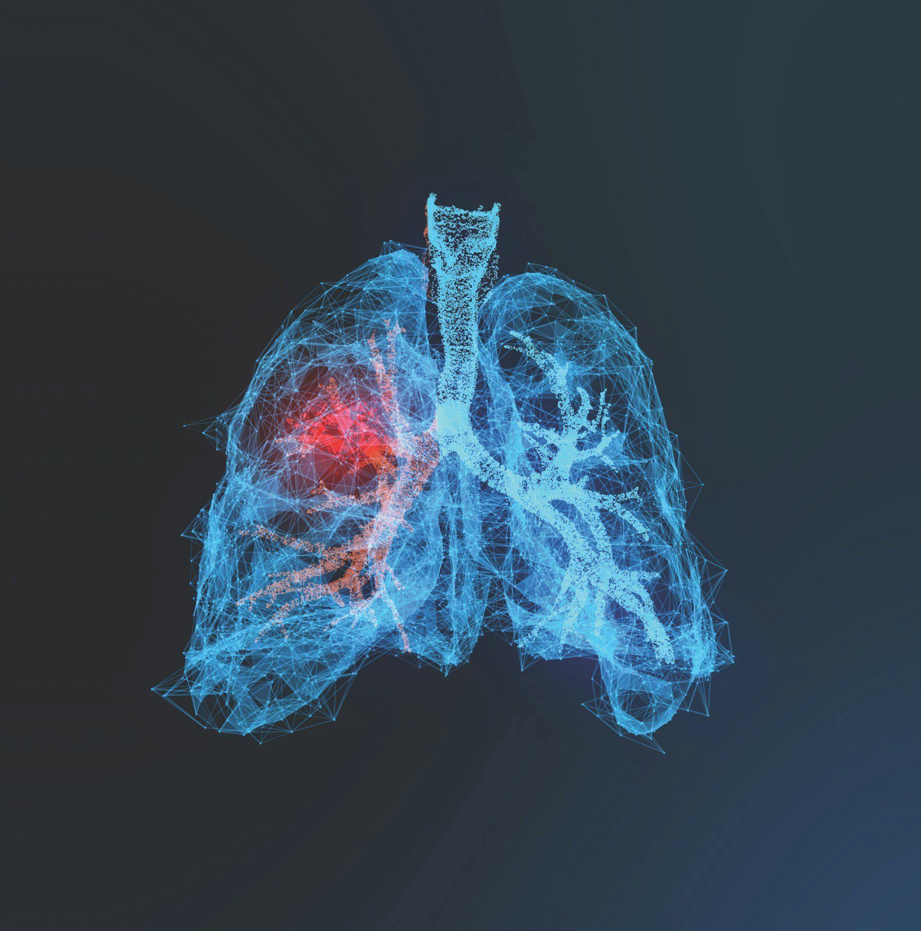 Diagnostic AI Tool for Identifying Early-Stage Lung Cancer Earns FDA 150(k) Clearance 