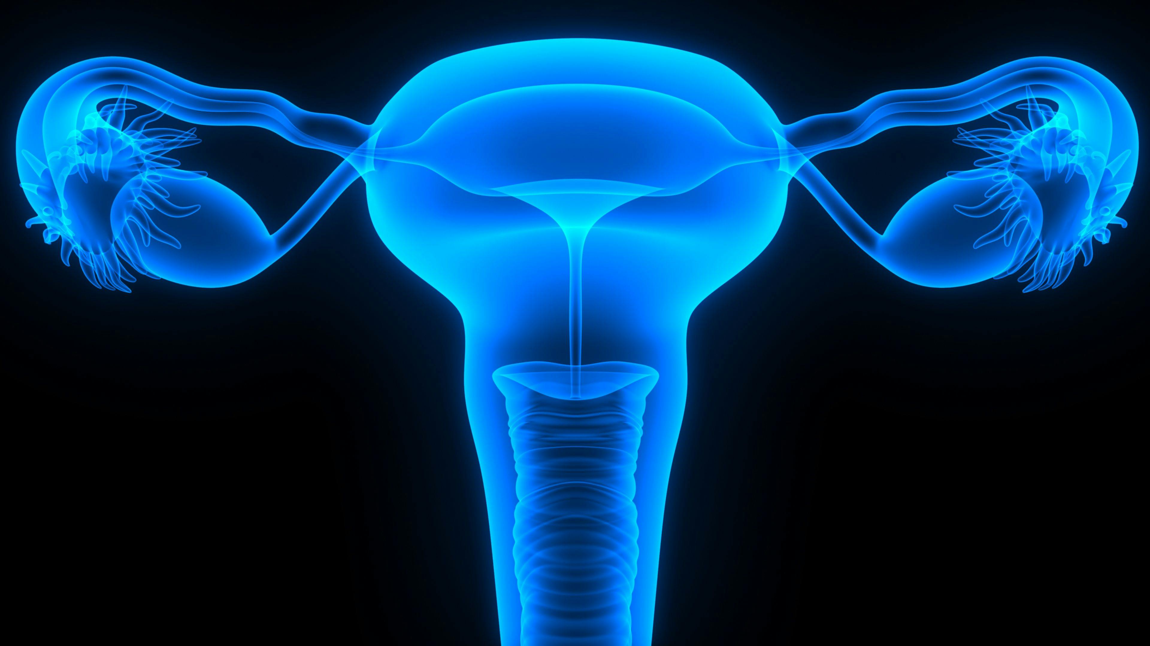 Addition of Olaparib to Cediranib Does Not Induce Superior Efficacy in Advanced Endometrial Cancer