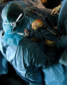 Study Supports Laparoscopic Surgery for Rectal Cancer