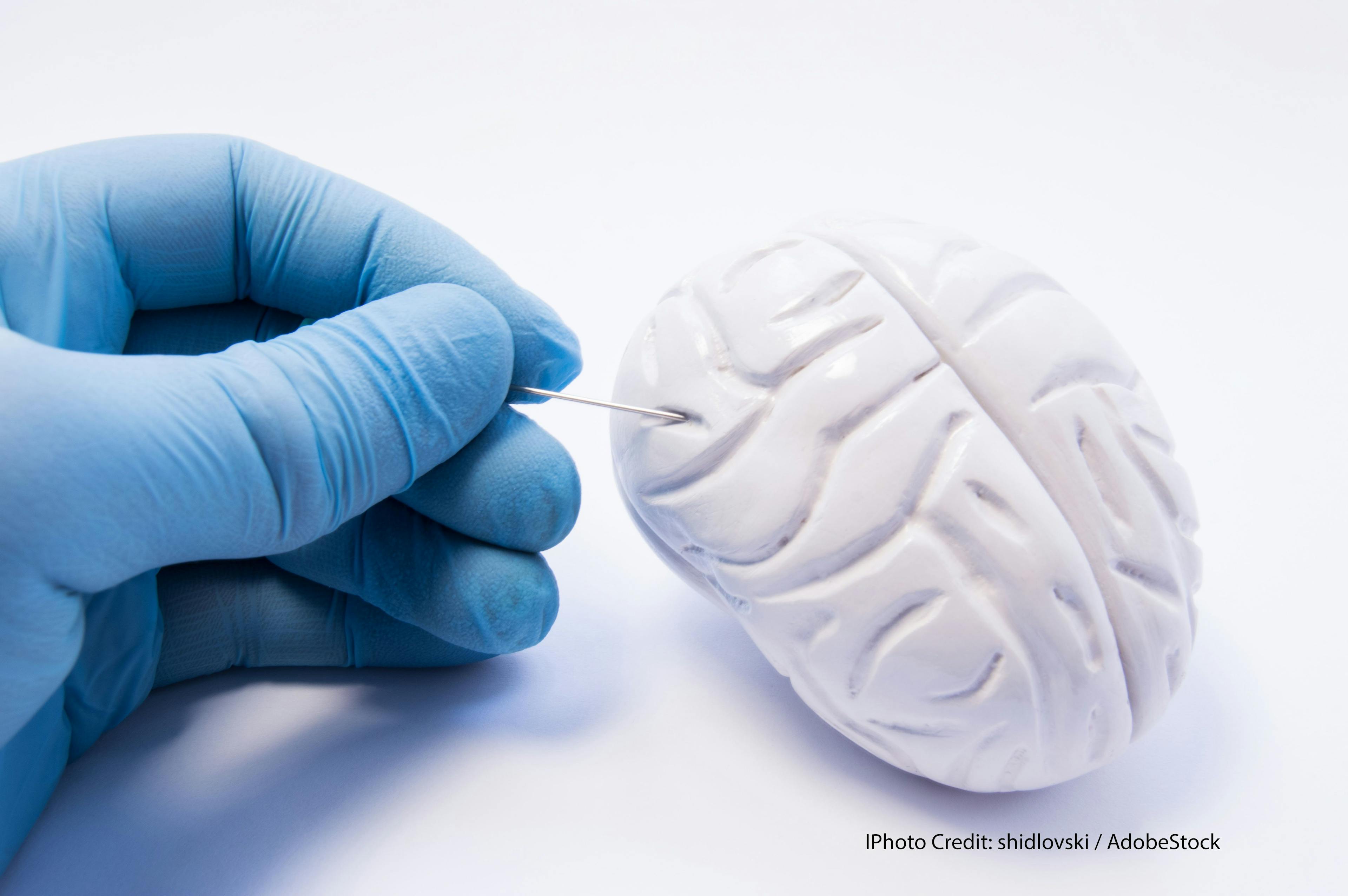 Do Bigger Brains Contribute to More Cancer?