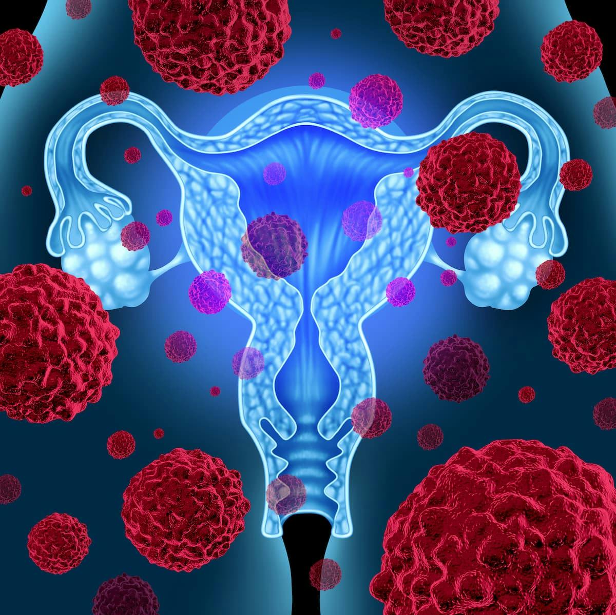 FDA Grants Priority Review to Pembrolizumab/Chemo in Endometrial Cancer | Image Credit: © freshidea - stock.adobe.com.