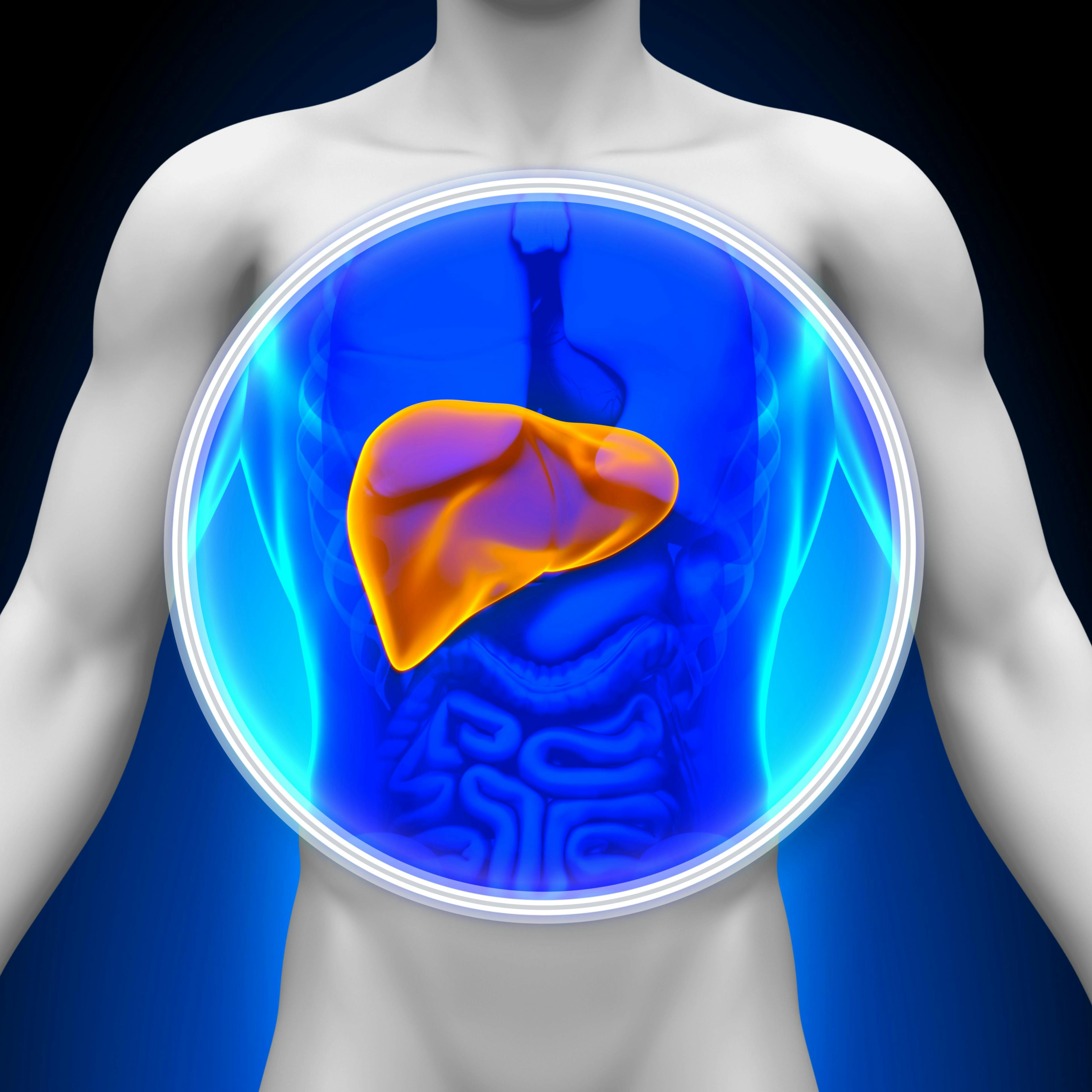 Patients with hepatocellular carcinoma and Child-Pugh-B liver function appear to have worse overall survival following treatment with regorafenib in the REFINE trial.