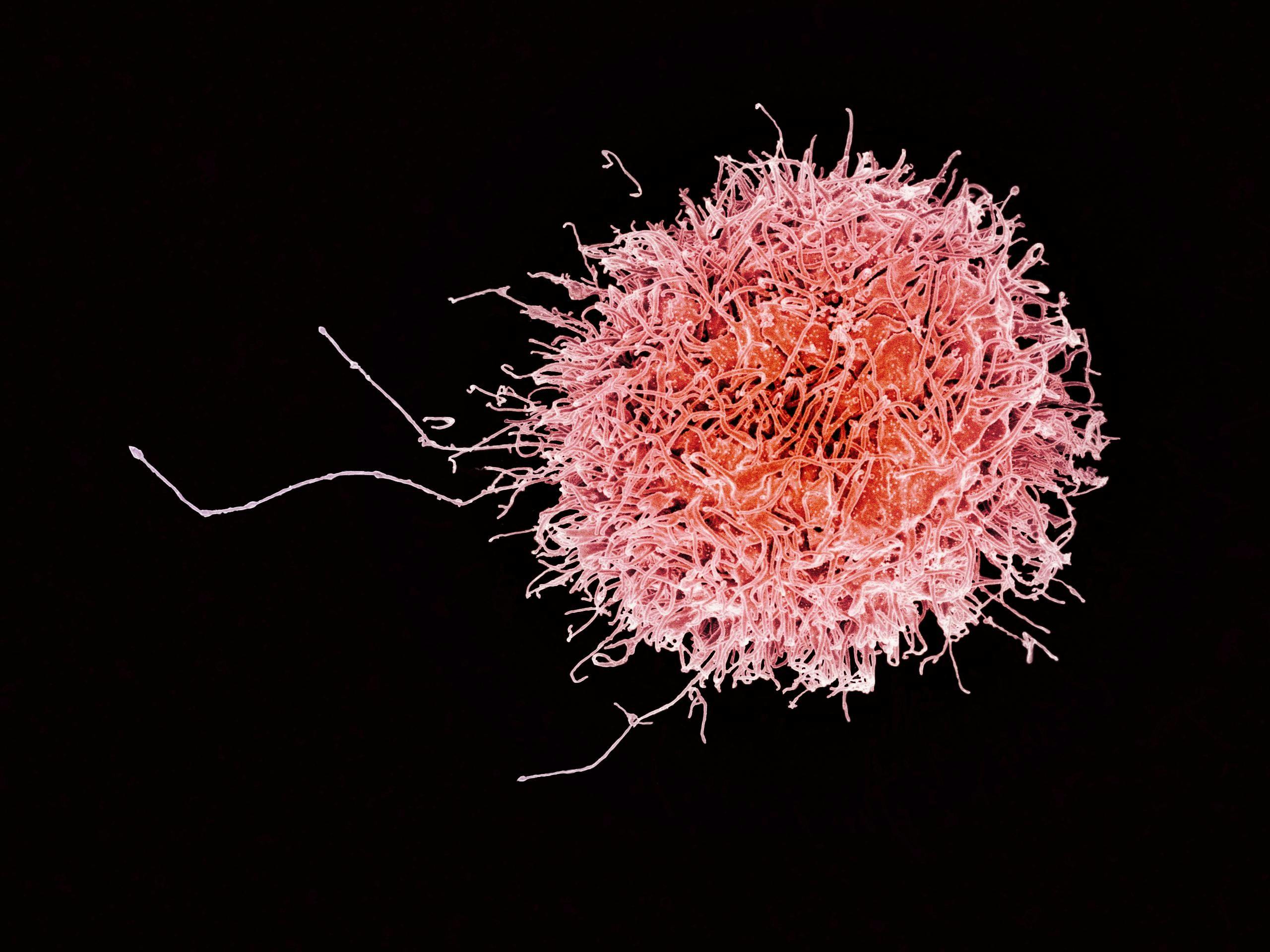 Image of a human natural killer cell