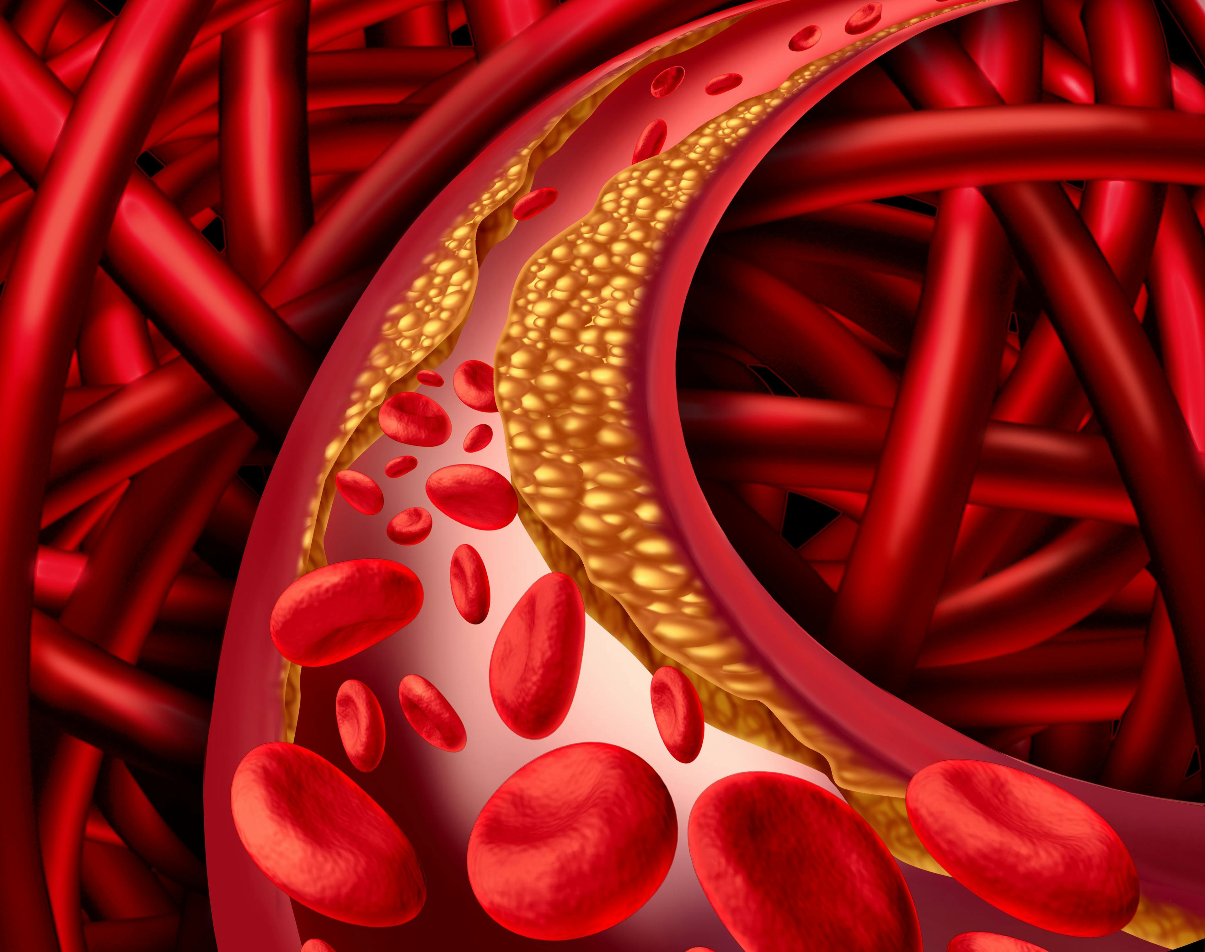 inflammatory activity in arteries