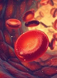 There remains a therapeutic challenge with understanding and treating patients with accelerated myeloproliferative neoplasms.