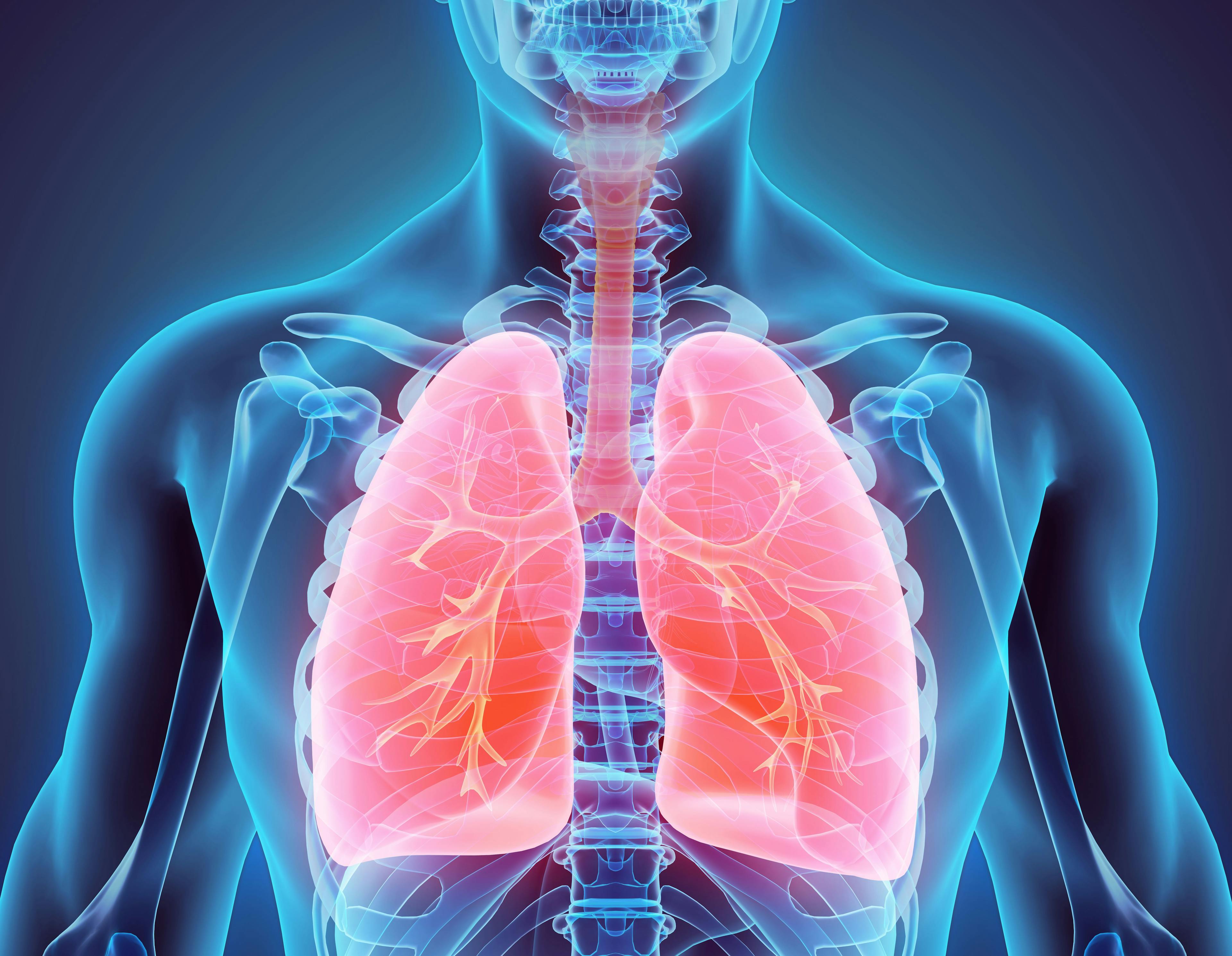 Optimizing Therapies For Patients With Lung Cancer
