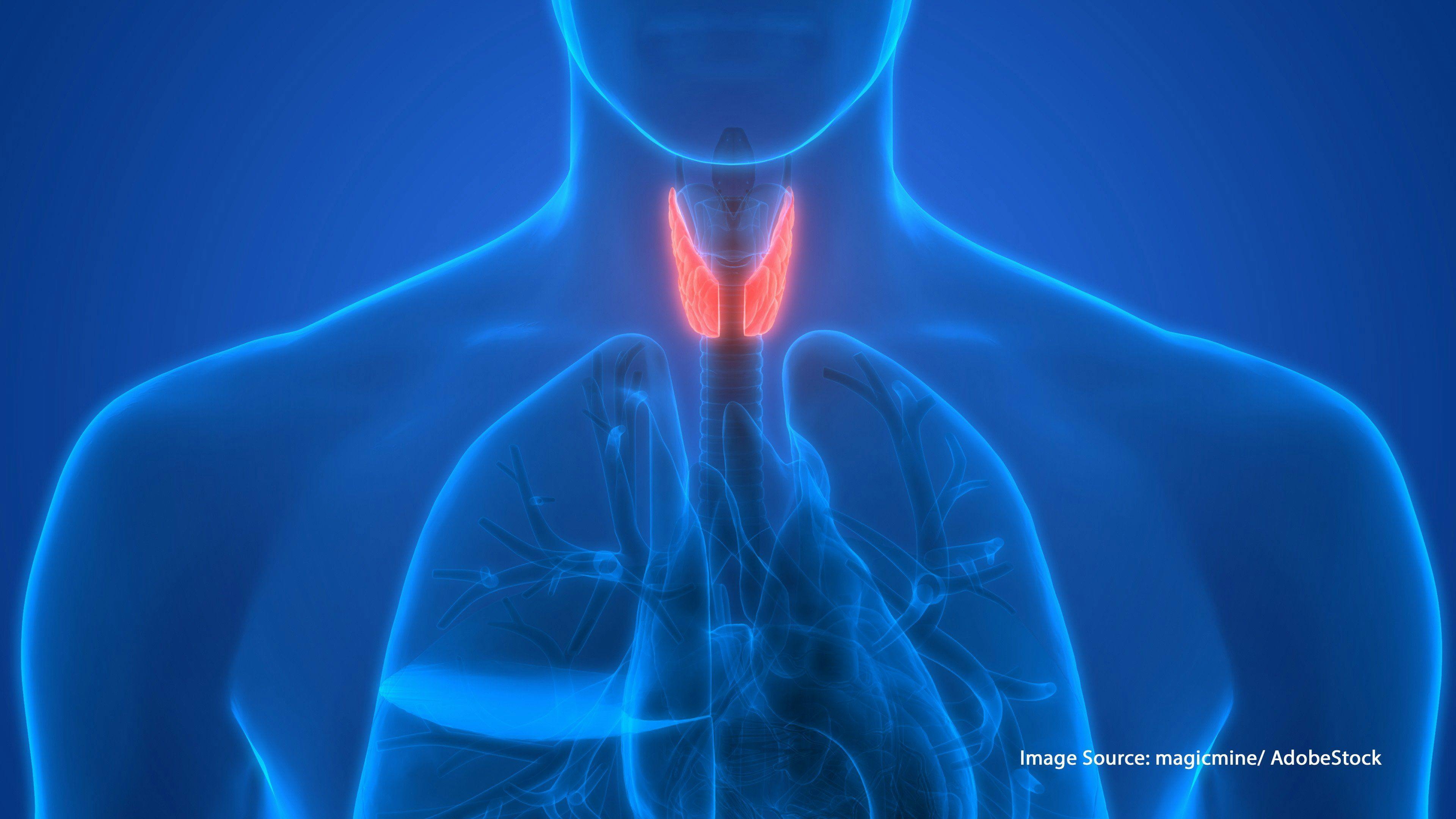 Study Investigates Survival Rates in Patients with Medullary Thyroid Carcinoma 