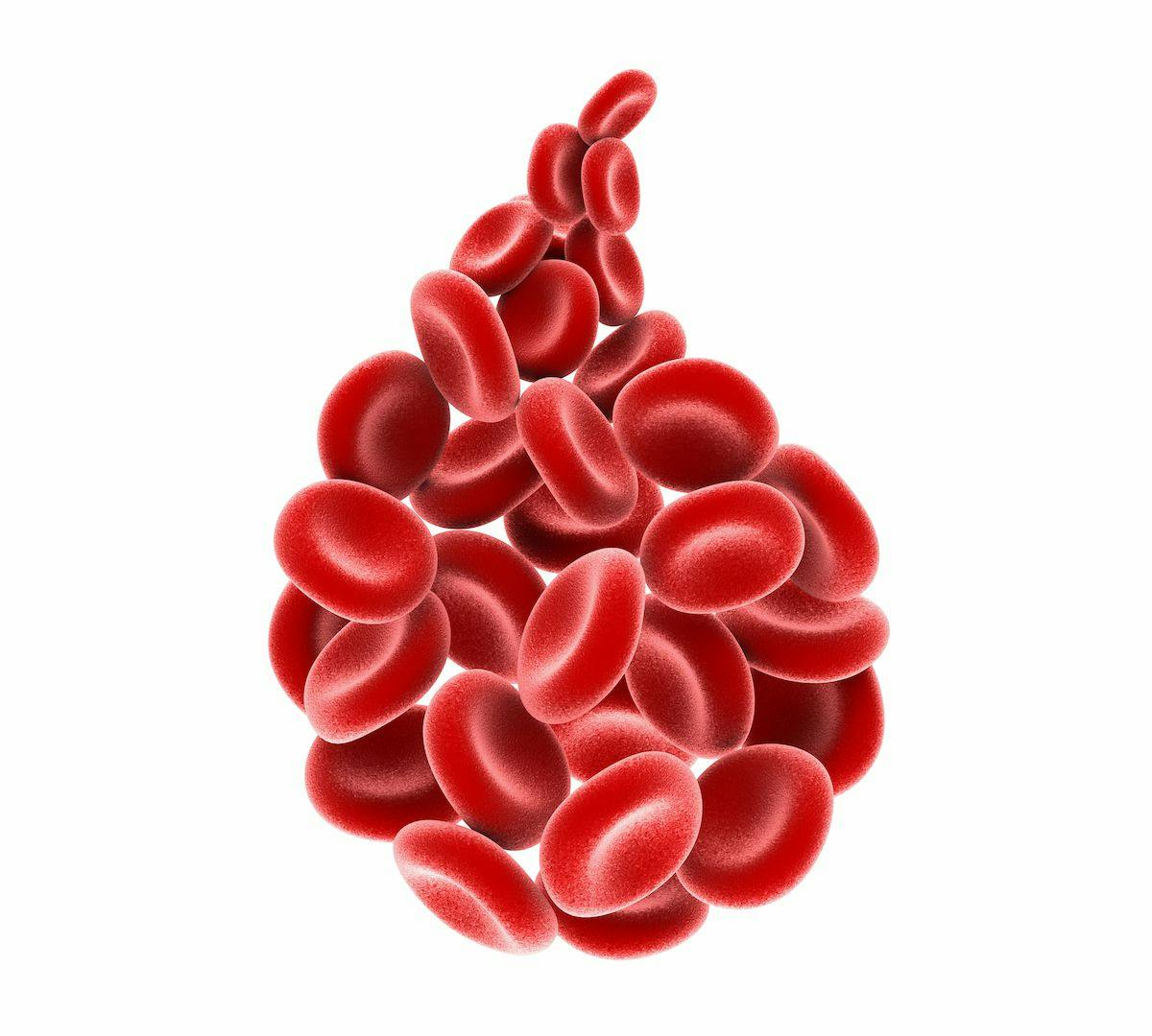 Patients with highly transfusion dependent, relapsed/refractory myelodysplastic syndrome appear to have long-lasting transfusion independence and increased hemoglobin following treatment with imetelstat.