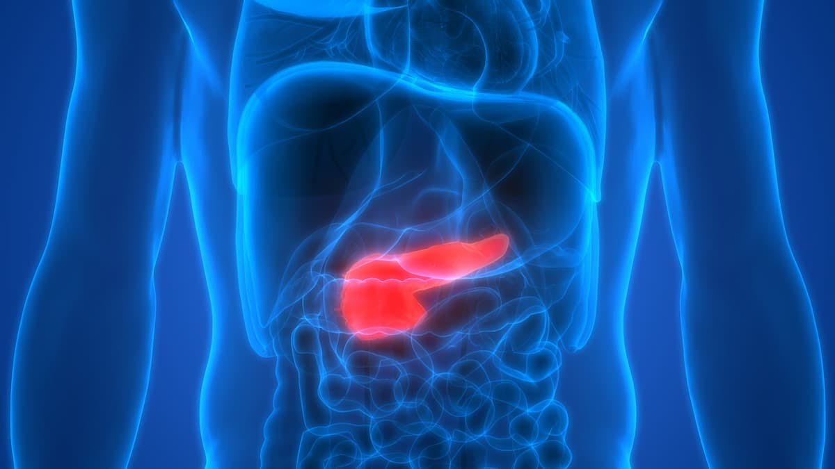 "We believe [osemitamab] has the potential to be transformative for [patients with] advanced pancreatic adenocarcinoma who lack effective therapeutic options," according to the manufacturers of osemitamab.