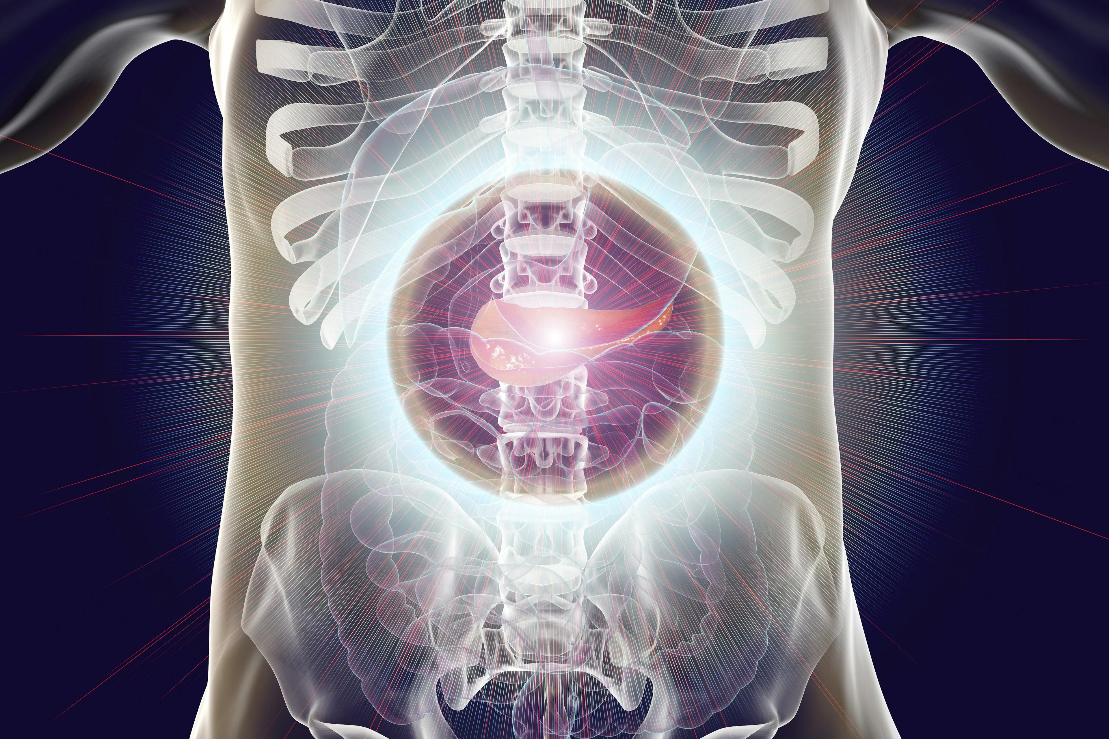 Results from a phase 1b/2 trial indicated that niraparib plus nivolumab yielded superior progression-free survival at 6 months vs niraparib and ipilimumab for patients with platinum-sensitive advanced pancreatic cancer. 