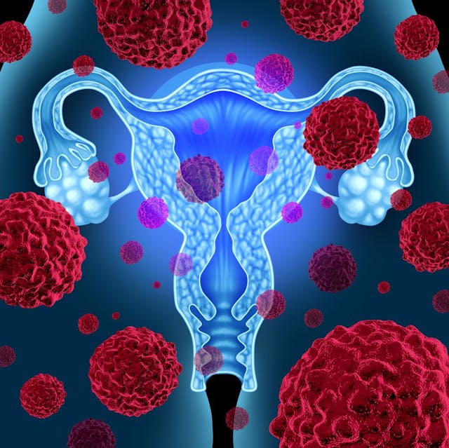 FDA Grants FTD to Prexasertib in Ovarian/Endometrial Cancers | Image Credit: © freshidea - stock.adobe.com.