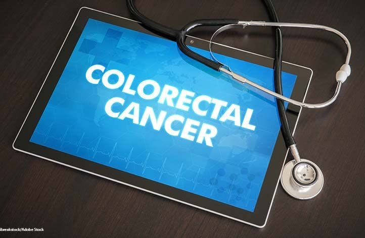 Timing of Colorectal Cancer Screening: How Current Guidelines Vary