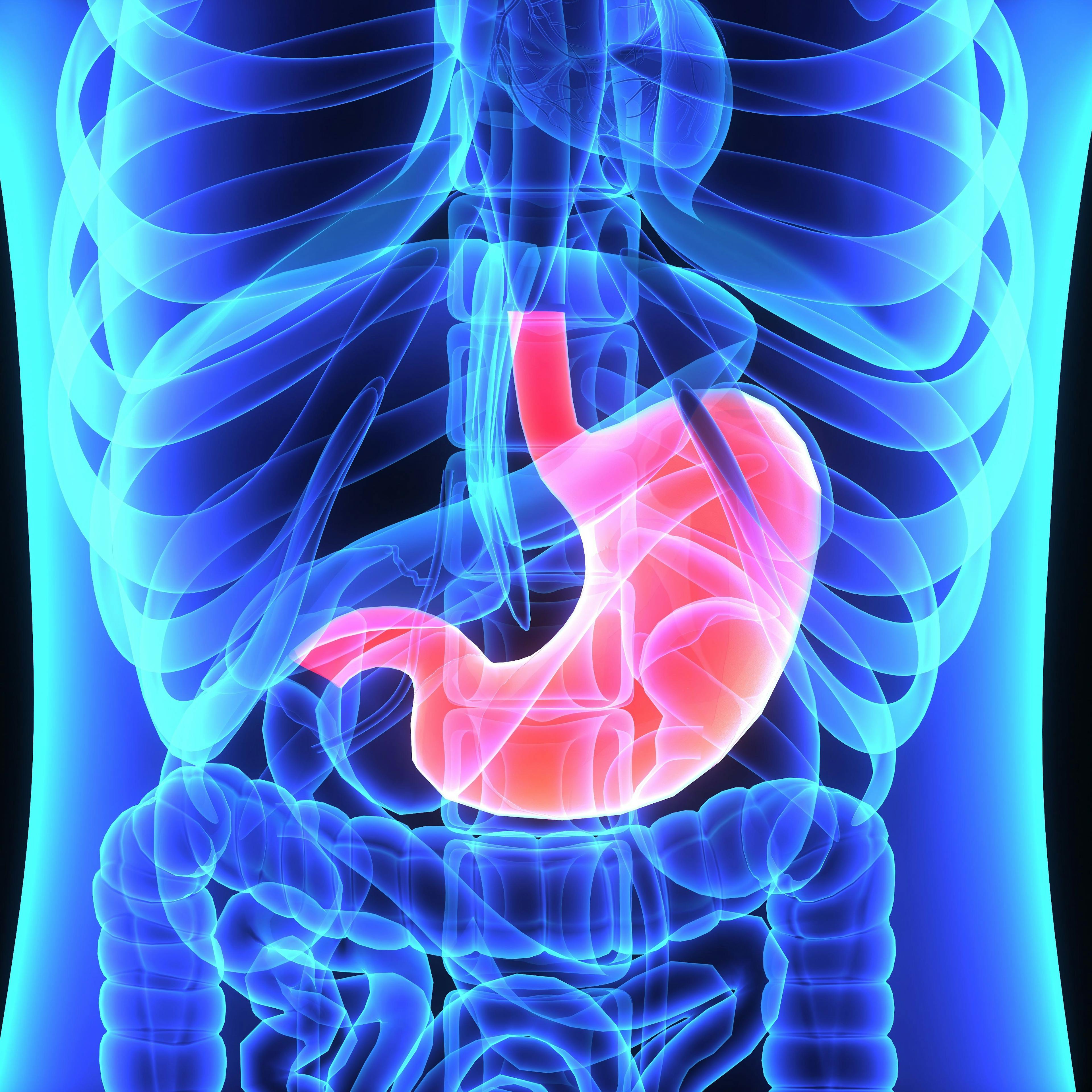 "Our findings suggest that regorafenib with nivolumab and chemotherapy is safe and showed promising anti-tumor activity in patients with advanced esophagogastric cancer," according to the authors of a phase 2 trial (NCT04757363).