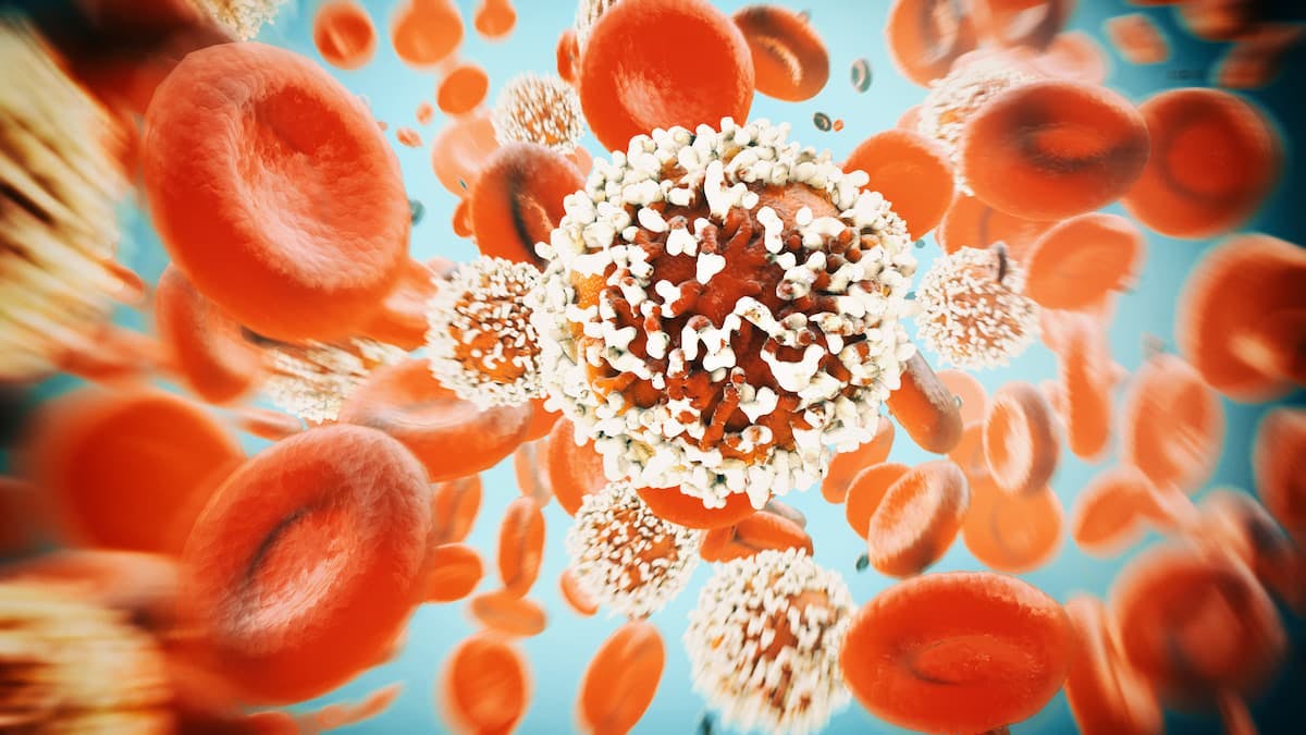 Relapsed Extranodal Natural Killer/T-cell Lymphoma May Benefit From Sugemalimab Therapy