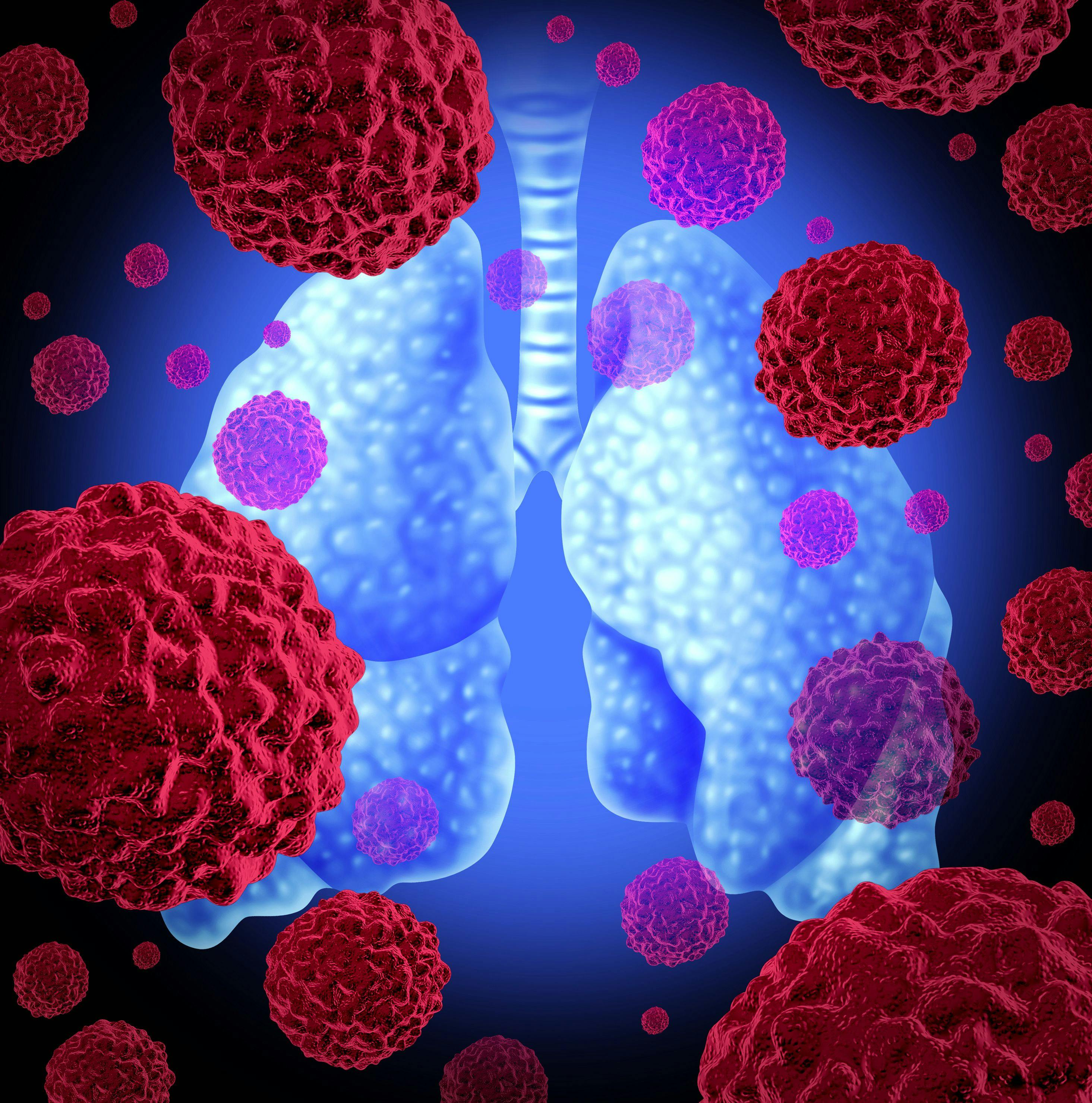 cancer cells targeting the lungs