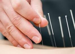 True Acupuncture Shows Promise for Patients with Head and Neck Cancer