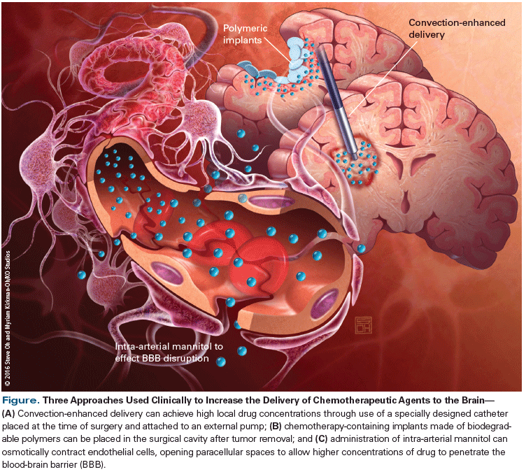 Optimizing the Delivery of Antineoplastic Therapies to the Central Nervous System 