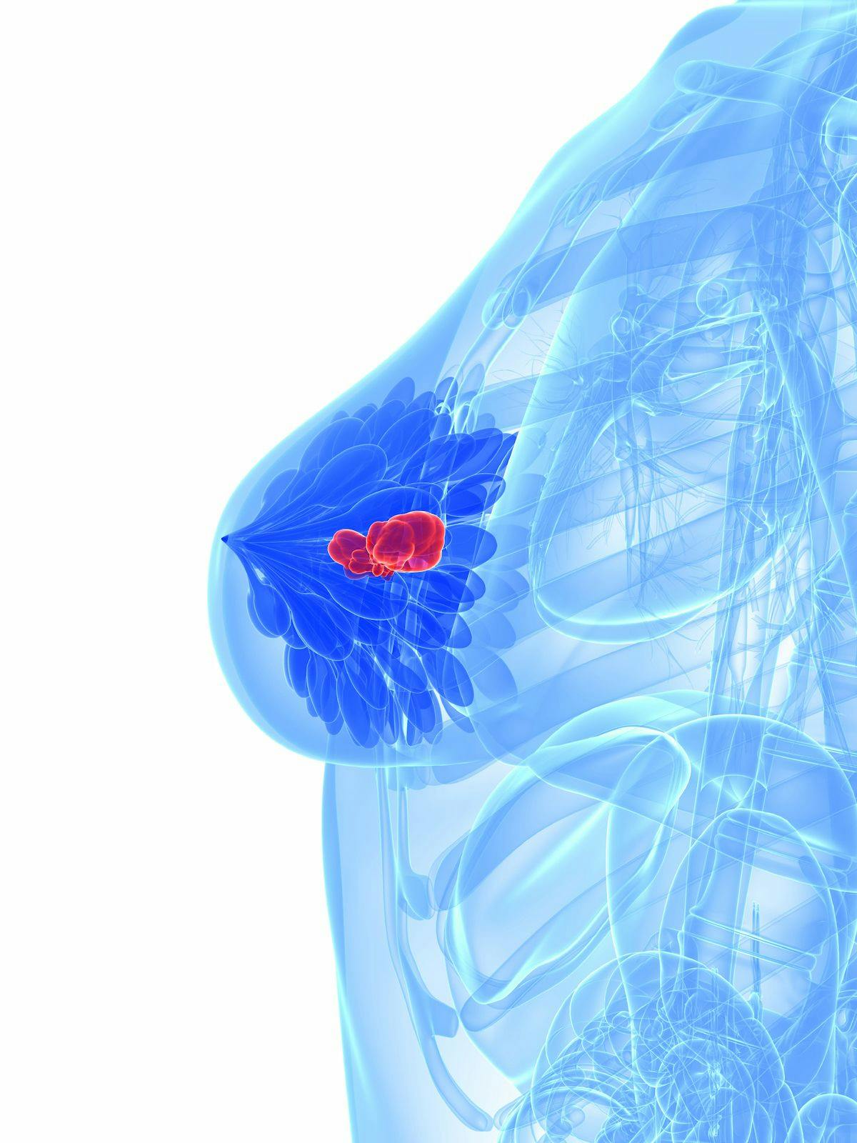 Investigators were able to identify breast cancer immunohistochemistry markers including Ki-67, estrogen receptor, and progesterone receptor status utilizing deep learning–based artificial intelligence algorithms