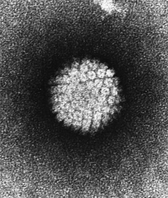 RNA Test for HPV Helps Stratify Cervical Cancer Risk