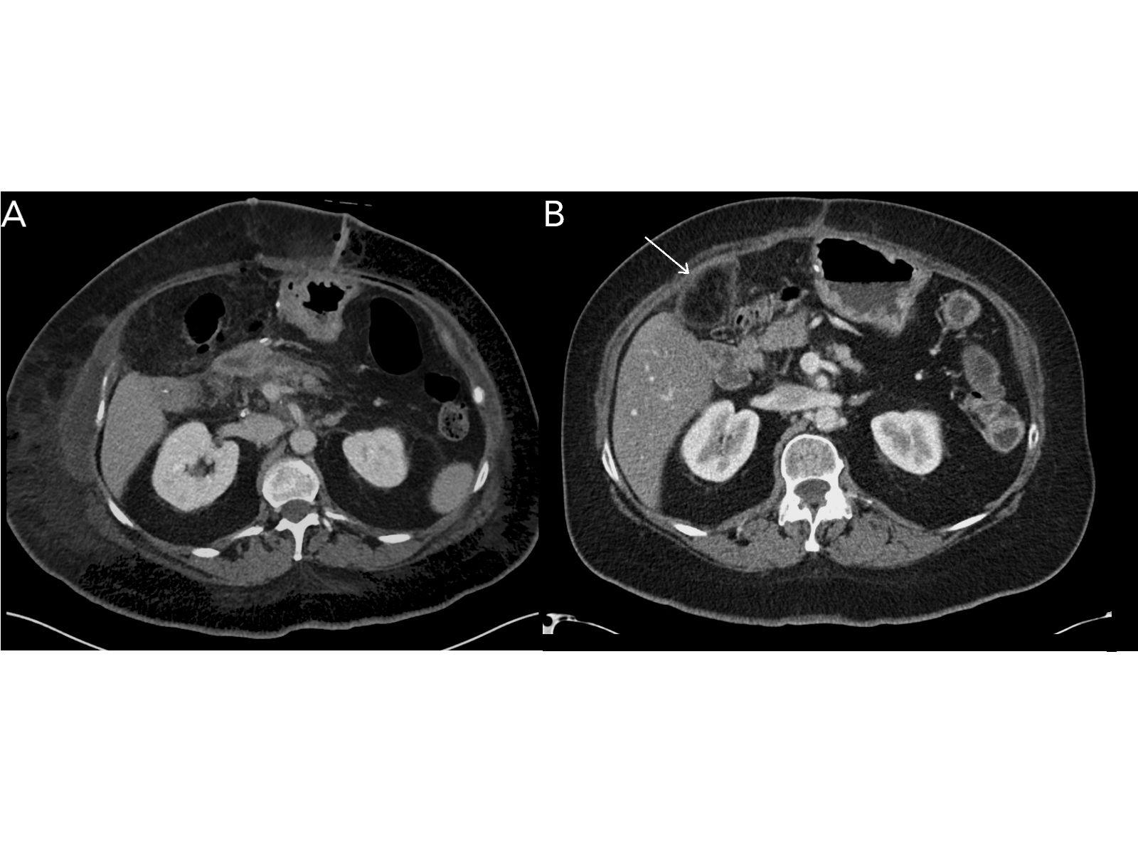 Diagnose the Mystery Structure in This Patient's CT Scans