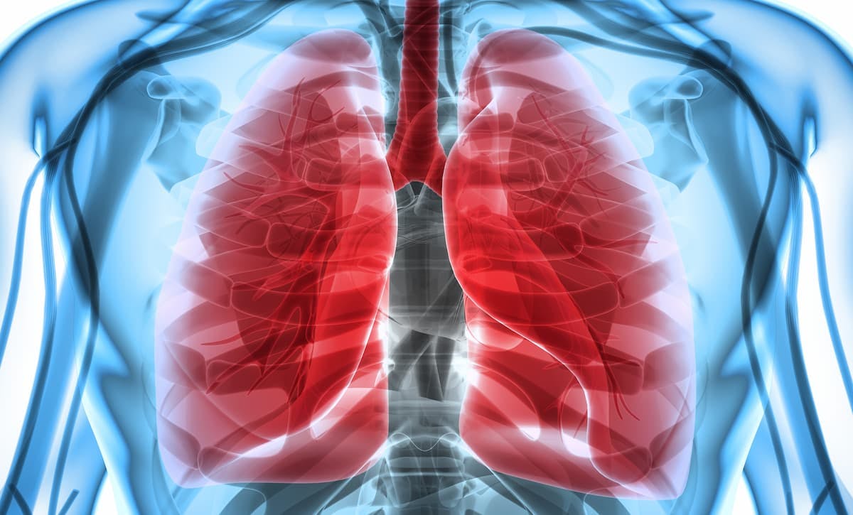 Overall Survival at 2 Years With Sotorasib for KRAS G12C+ NSCLC Continues to Impress